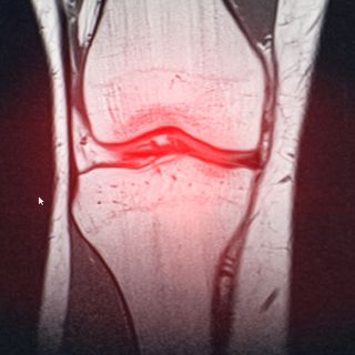 Ruston ja kudosten uudistuminen